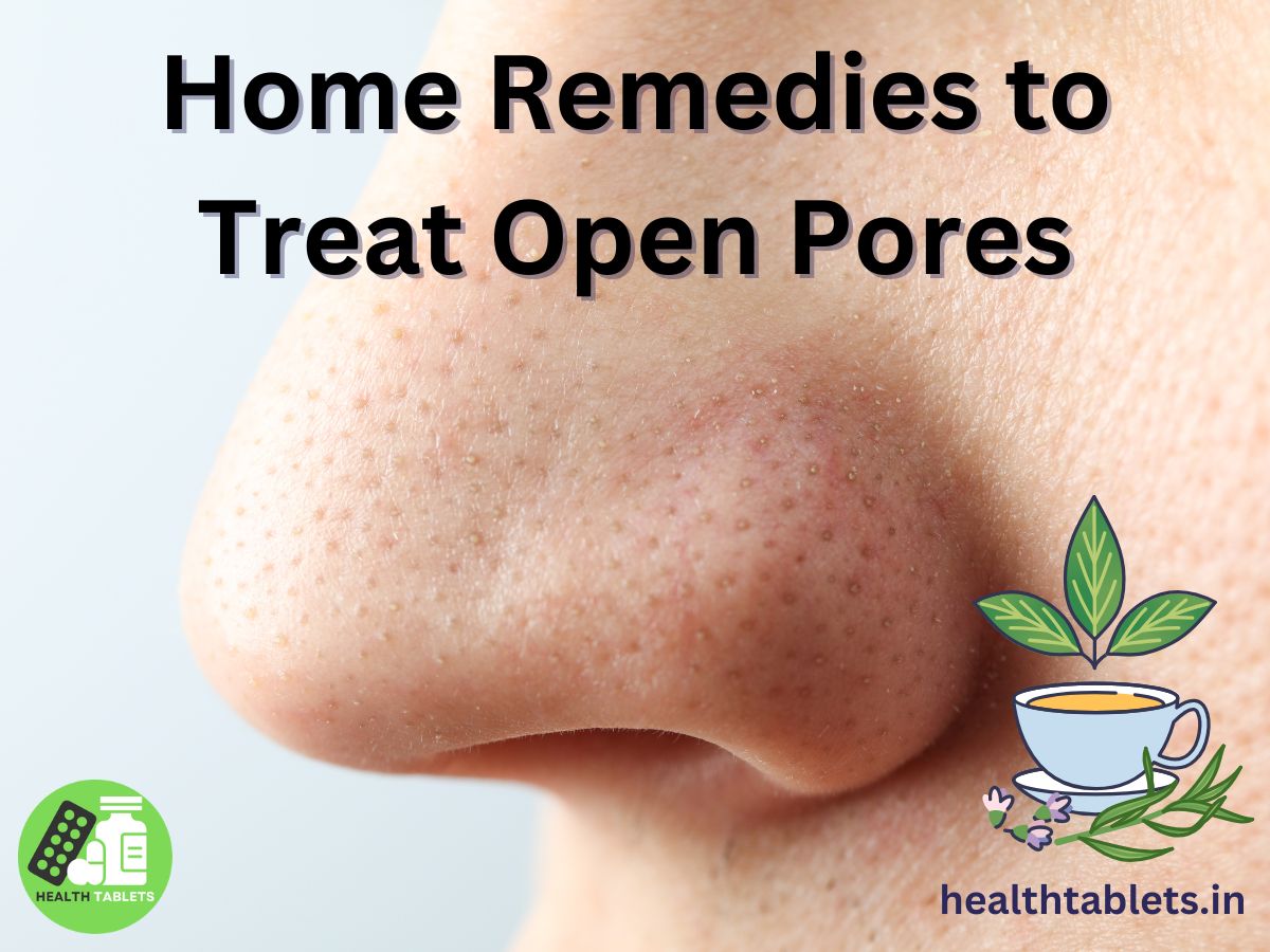 Home Remedies to Treat Open Pores